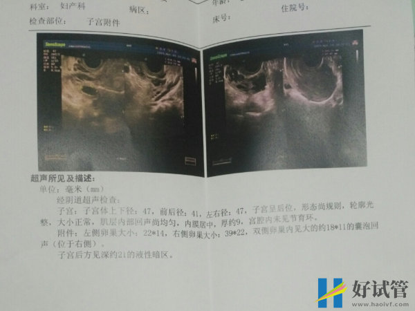 保山施甸县试管婴儿哪个医院好？(图1)