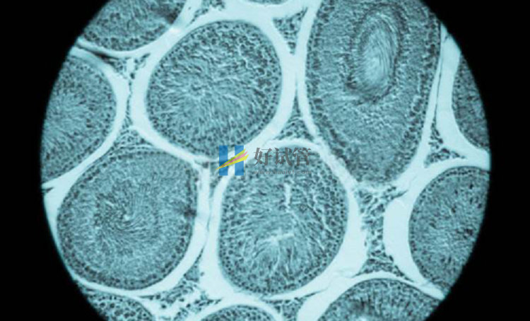 卵巢功能衰退影响怀孕