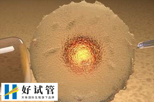 俄罗斯试管婴儿是合法的