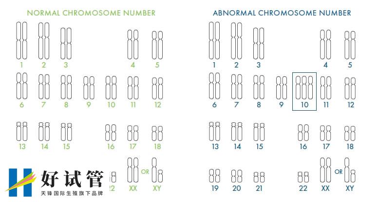 染色体非整倍体