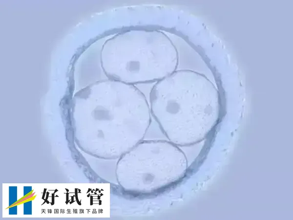 胚胎移植后女性要多注意休息