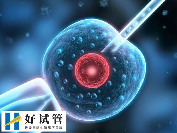 取卵手术是一个相对简单的过程