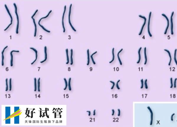 染色体CNV缺失是基因组结构变异的一种形式