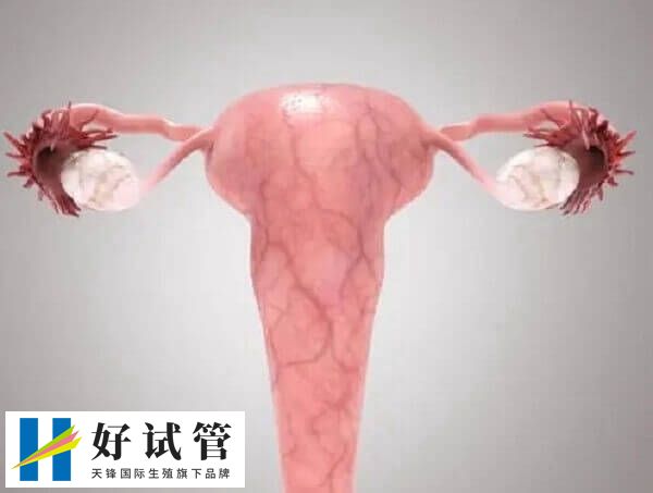 子宫腺肌症用达菲林治疗可能会导致闭经